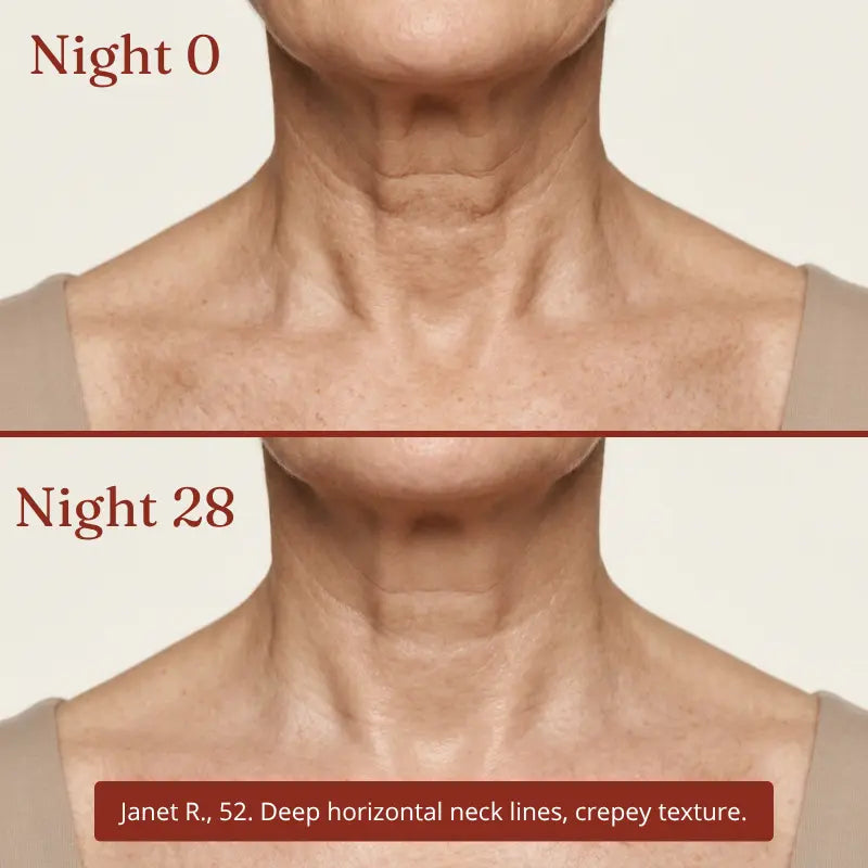 Collagen Night Wrapping Mask — Neck & Décolleté