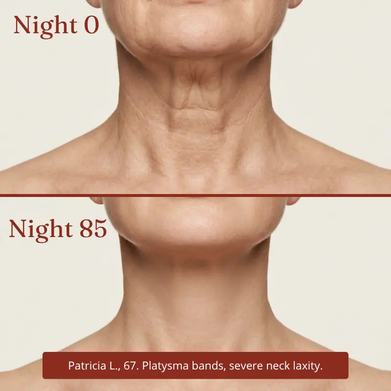 Collagen Night Wrapping Mask — Neck & Décolleté