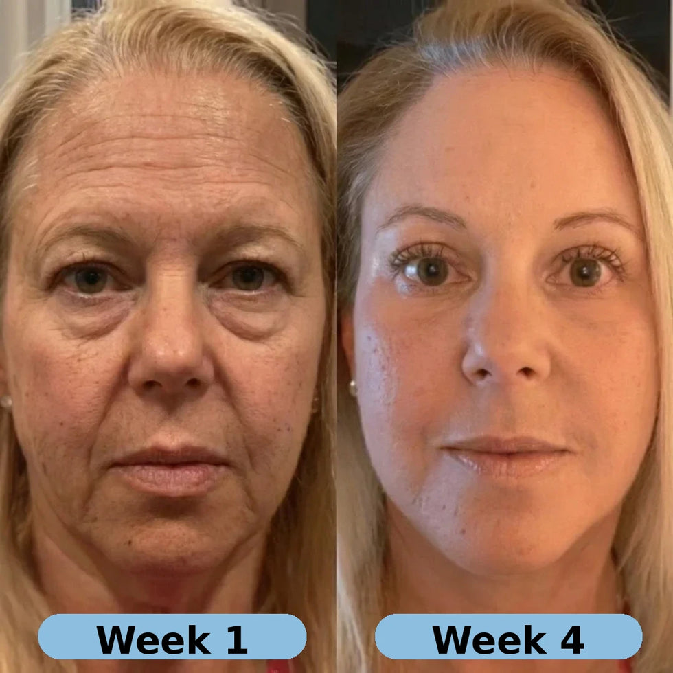 Gyrah Volufiline Serum
