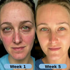Gyrah Volufiline Serum
