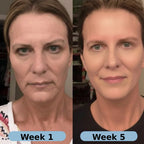 Gyrah Volufiline Serum